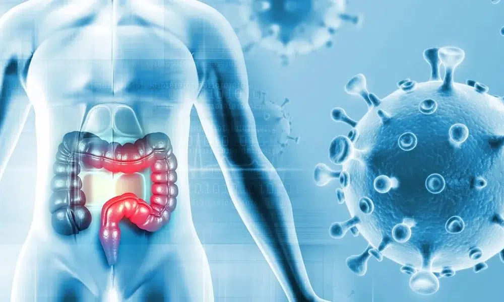 Καρκίνος στο Έντερο: Η ύποπτη τοξίνη πίσω από την αύξηση περιστατικών σε νέους κάτω των 50